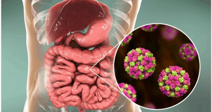 El norovirus (enfermedad del vómito invernal) aumenta durante los viajes de vacaciones; explicación de la cobertura del seguro de viaje